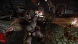 Dragon Age Origins  Darkspawn Chronicles 4