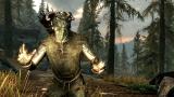 Skyrim-Patch, Xbox 720-Designs, Zelda-Raum - Die heißesten Community-Themen der Woche