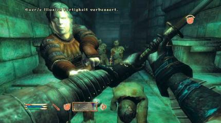 Während die Zombies ohne Rücksicht auf Verluste auf Sie einstürmen, können Sie sich bei dem Gegner links im Bild mit porphyrischer Hämophilie anstecken: Vampirismus! 
BILD: PLAYZONE